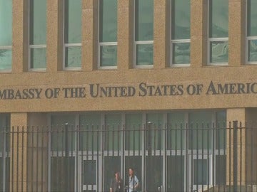 EE.UU. estudia cerrar su embajada en La Habana por presunto "ataque acústico"
