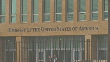 EE.UU. estudia cerrar su embajada en La Habana por presunto "ataque acústico"