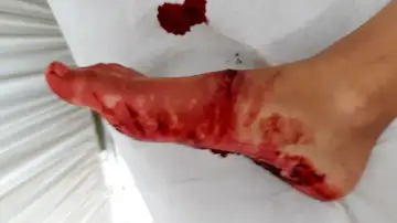 Ataque de un tiburón Ataque de un tiburón