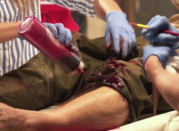 La operación de pierna de Vicente Romero en 'Tiempos de guerra'
