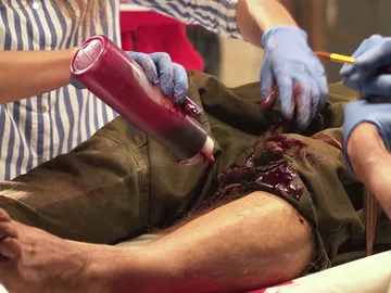 La operación de pierna de Vicente Romero en 'Tiempos de guerra' La operación de pierna de Vicente Romero en 'Tiempos de guerra'