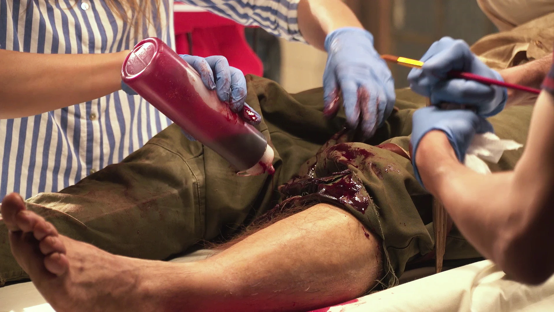 La operación de pierna de Vicente Romero en 'Tiempos de guerra'