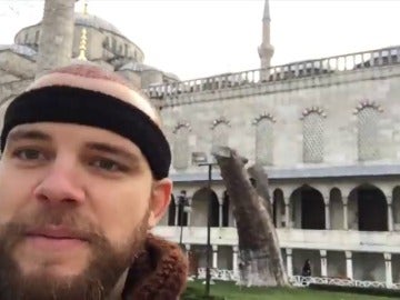 Miles de extranjeros viajan cada año a Turquía para acabar con su calvicie Miles de extranjeros viajan cada año a Turquía para acabar con su calvicie