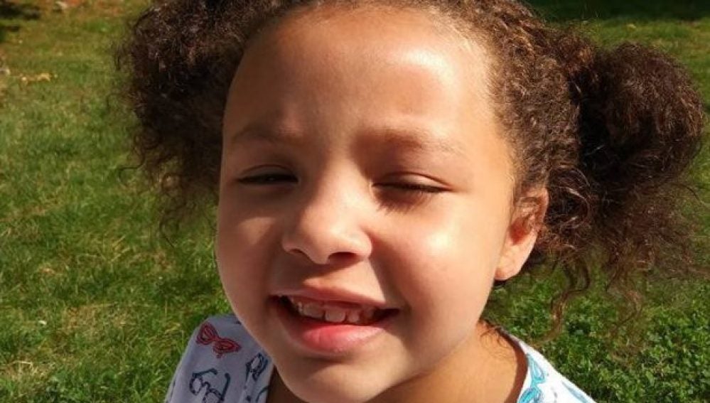 Tru, la niña a la que han rapado la cabeza sin el permiso de su madre
