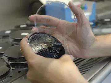 Una muestra es analizada en un laboratorio, en busca del foco de legionela Una muestra es analizada en un laboratorio, en busca del foco de legionela