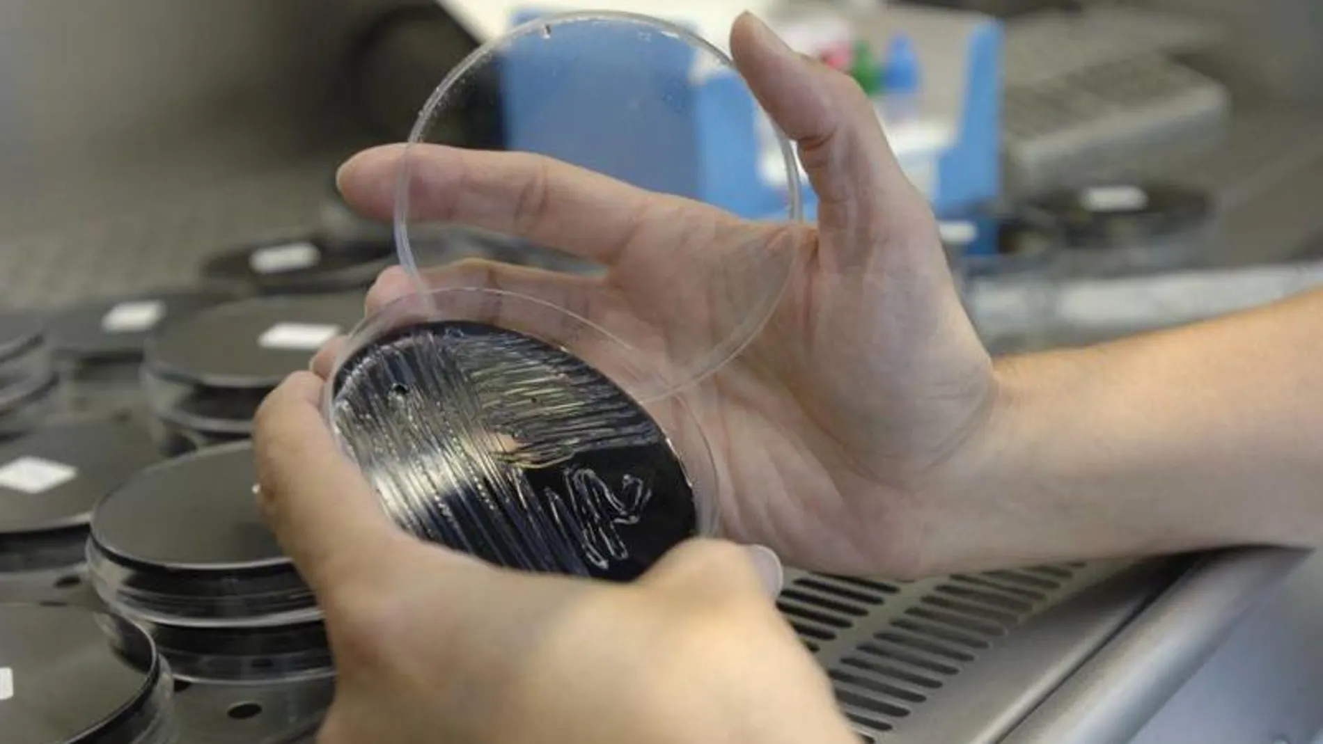 Una muestra es analizada en un laboratorio, en busca del foco de legionela Una muestra es analizada en un laboratorio, en busca del foco de legionela