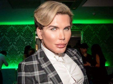 Rodrigo Alves, el Ken humano