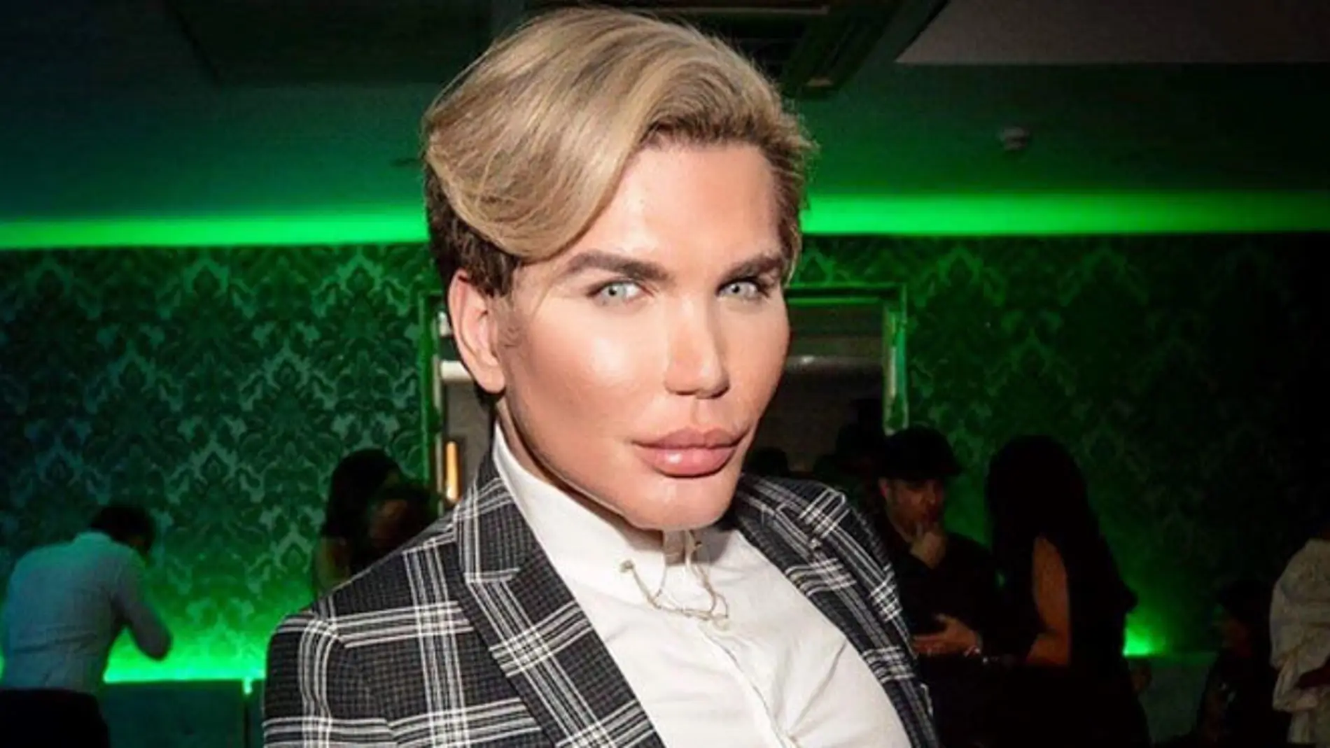 Rodrigo Alves, el Ken humano