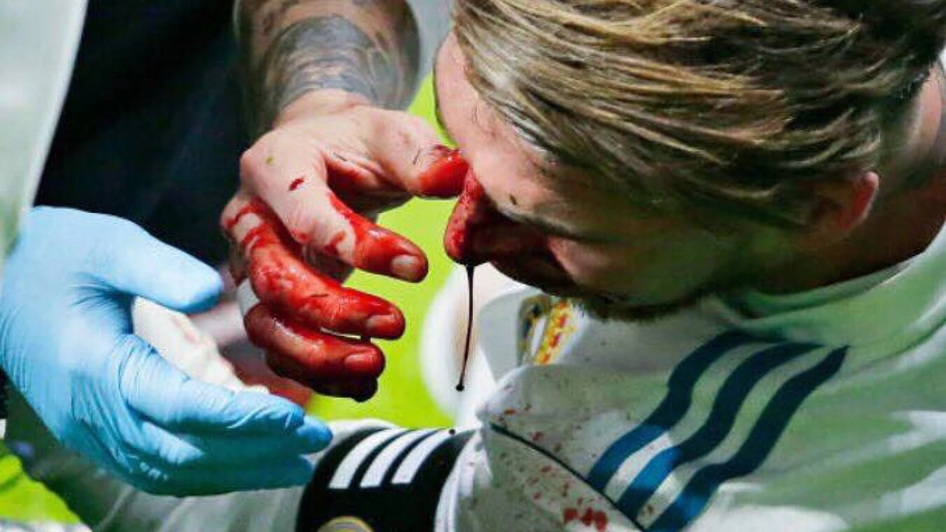 Sergio Ramos, sangrando Sergio Ramos, sangrando