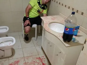 Uno de los colegiados agredido en Argentina Uno de los colegiados agredido en Argentina