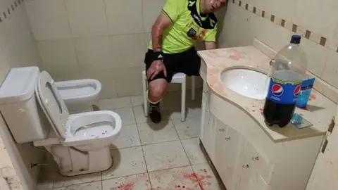 Uno de los colegiados agredido en Argentina Uno de los colegiados agredido en Argentina