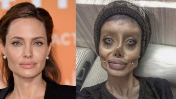 Se opera más de 50 veces para parecerse a Angelina Jolie