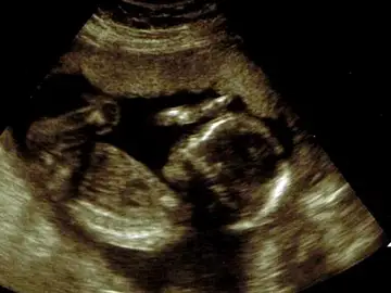 Imagen de archivo de una ecografía Imagen de archivo de una ecografía