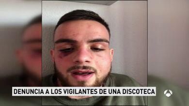 Un joven denuncia la paliza los porteros de una discoteca de Granada: 
