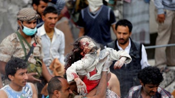 La masacre en Yemen, Khaled Abdullah