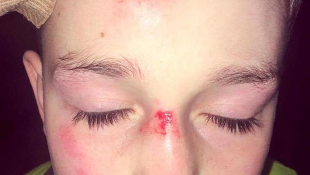 Las heridas que le hicieron al pequeño