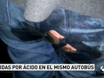 Heridas por ácido Heridas por ácido
