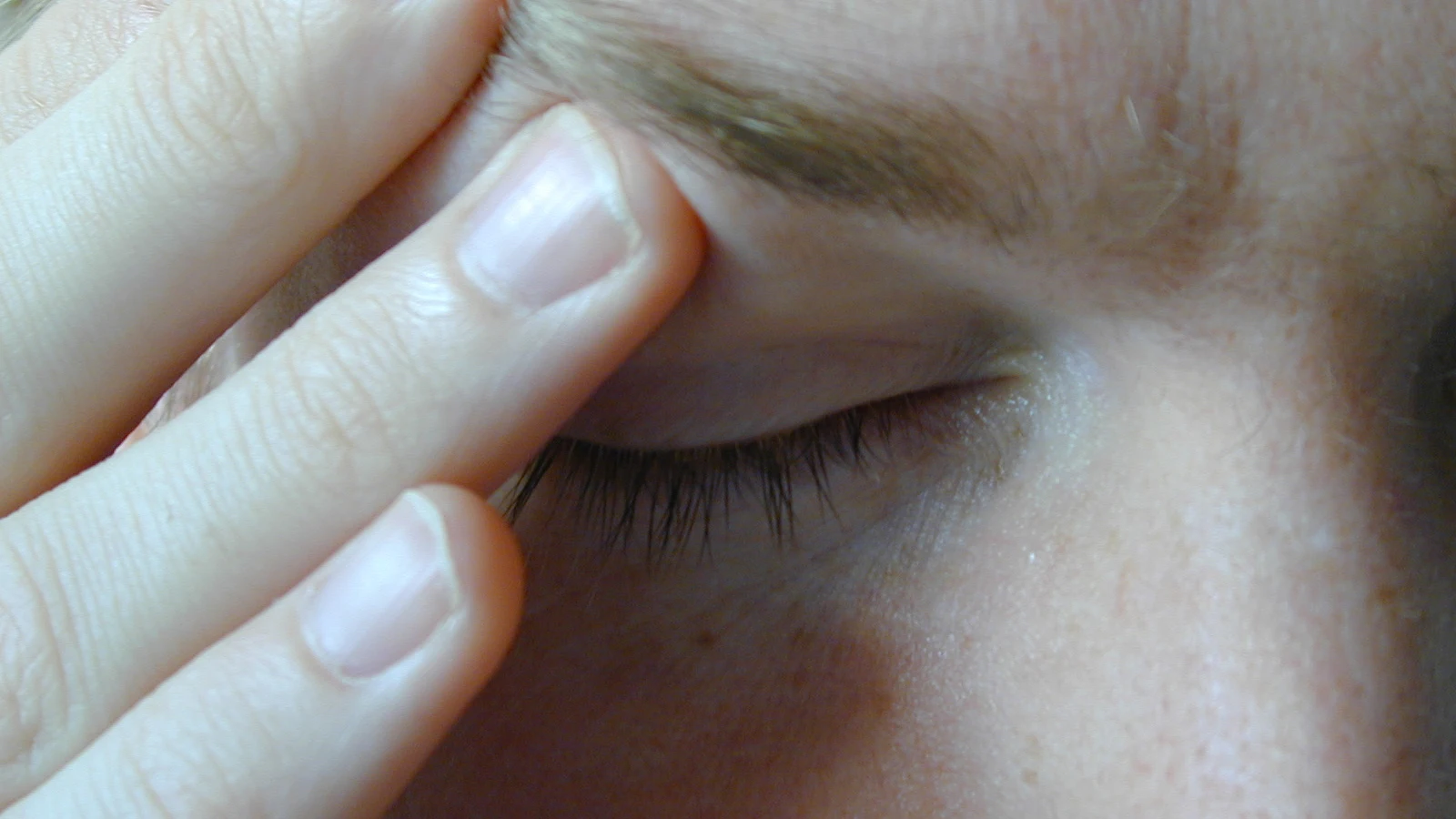 Paciente con migraña. Fuente: Morguefile. Paciente con migraña. Fuente: Morguefile.