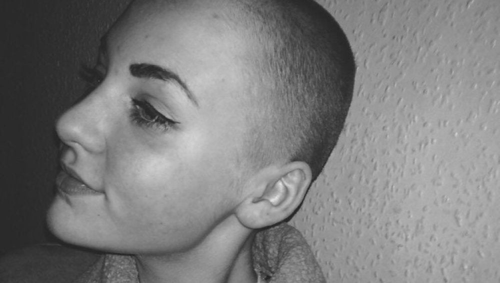 Niamh Baldwin, la adolescente de 14 años castigada por raparse para ayudar a enfermos de cáncer