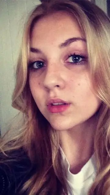 Niamh Baldwin antes de raparse para ayudar a enfermos de cáncer Niamh Baldwin antes de raparse para ayudar a enfermos de cáncer