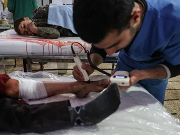 Un médico atiende a una víctima de un bombardeo en Siria Un médico atiende a una víctima de un bombardeo en Siria