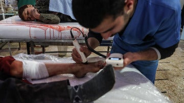 Un médico atiende a una víctima de un bombardeo en Siria