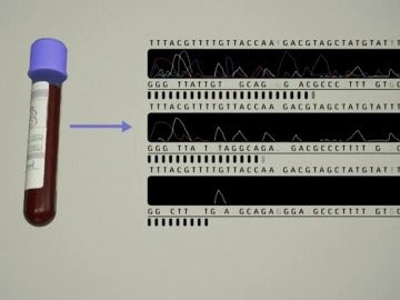 Un test de sangre podría permitir la detección temprana de ocho tipos comunes de cáncer