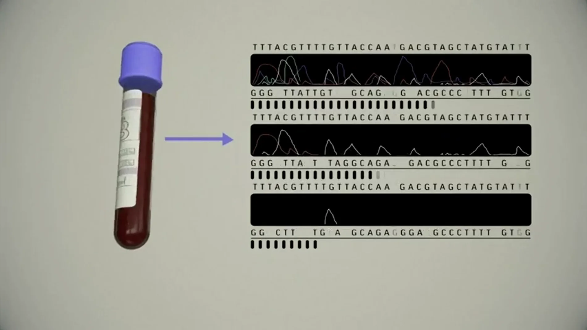 Un test de sangre podría permitir la detección temprana de ocho tipos comunes de cáncer Un test de sangre podría permitir la detección temprana de ocho tipos comunes de cáncer