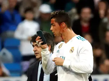 Cristiano Ronaldo, con un móvil para verse una herida Cristiano Ronaldo, con un móvil para verse una herida