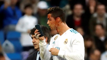 Cristiano Ronaldo, con un móvil para verse una herida