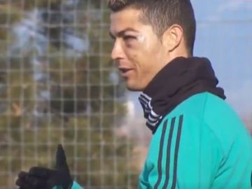 Cristiano reparece con un bulto en el ojo