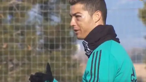 Cristiano reparece con un bulto en el ojo Cristiano reparece con un bulto en el ojo