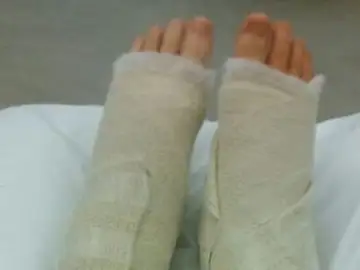 Nikitta se rompió los dos tobillos Nikitta se rompió los dos tobillos