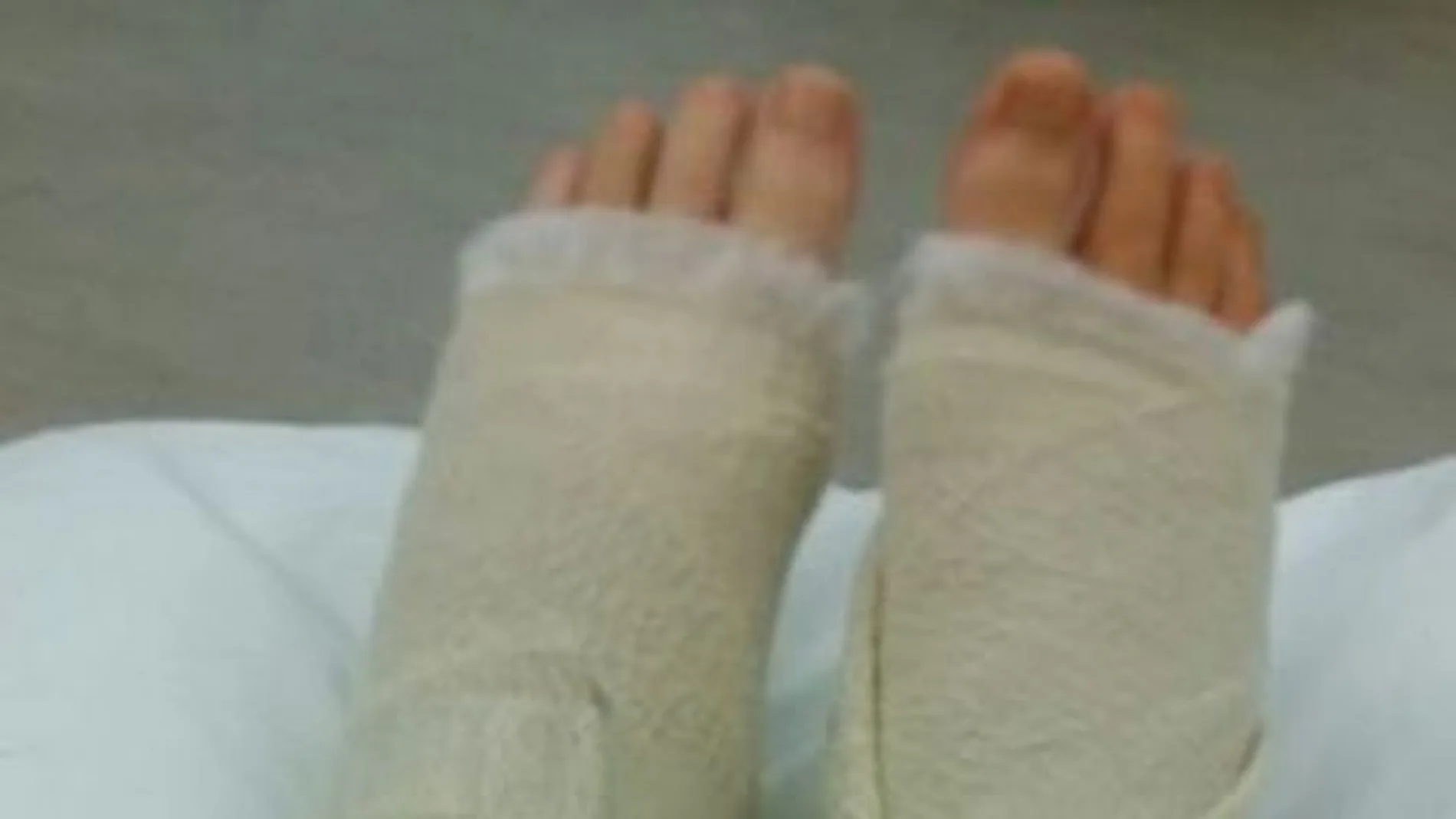 Nikitta se rompió los dos tobillos Nikitta se rompió los dos tobillos