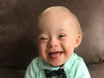 Lucas, el primer bebé con síndrome Down que es imagen de la marca Gerber Lucas, el primer bebé con síndrome Down que es imagen de la marca Gerber