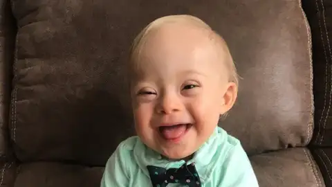 Lucas, el primer bebé con síndrome Down que es imagen de la marca Gerber Lucas, el primer bebé con síndrome Down que es imagen de la marca Gerber