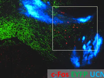 Luz y nanoparticulas para estimular las profundidades del cerebro Luz y nanoparticulas para estimular las profundidades del cerebro