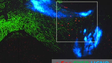 Luz y nanoparticulas para estimular las profundidades del cerebro