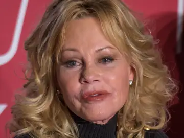 Algo le ha pasado en la cara a Melanie Griffith Algo le ha pasado en la cara a Melanie Griffith