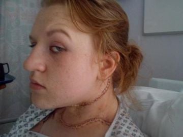 Cerys Head, tras ser operada de cáncer de tiroides