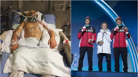 Mark McMorris, 'snowboarder' que estuvo muy grave y ha ganado el bronce en PyeongChang Mark McMorris, 'snowboarder' que estuvo muy grave y ha ganado el bronce en PyeongChang
