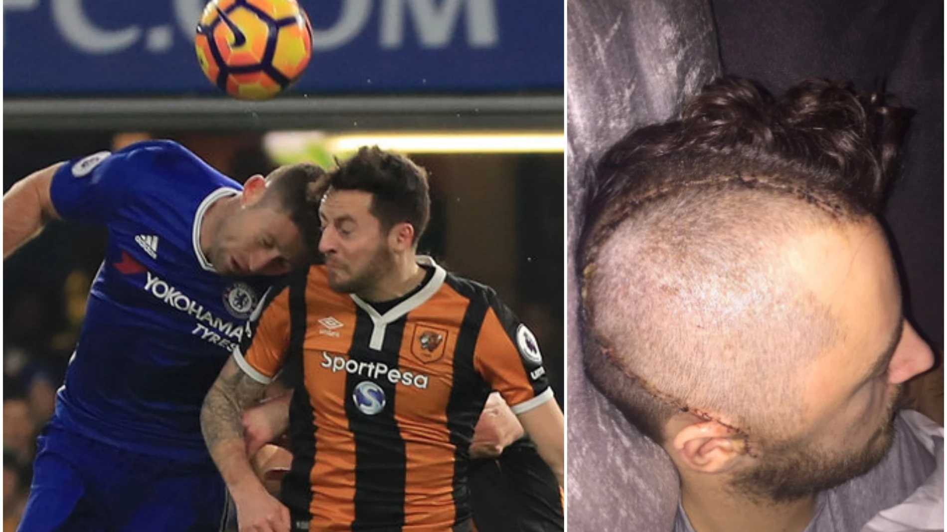 Ryan Mason tuvo que ser operado de la cabeza tras sufrir una fractura craneal Ryan Mason tuvo que ser operado de la cabeza tras sufrir una fractura craneal