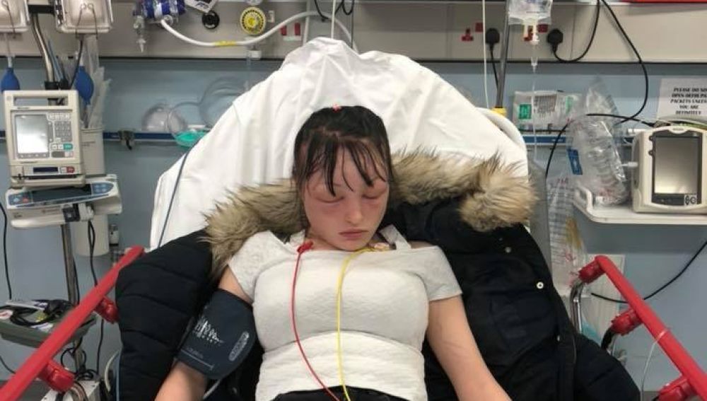 La joven durante su ingreso en el hospital