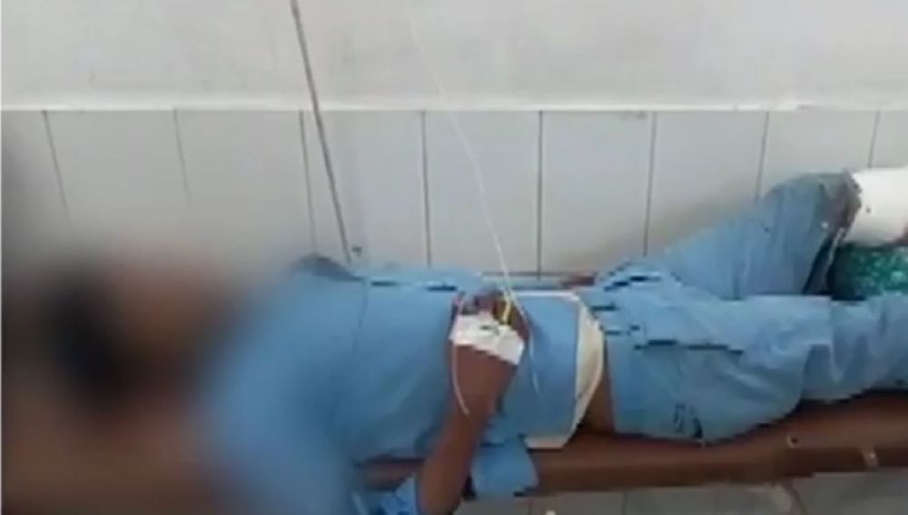 El hombre con la pierna supuestamente utilizada como almohada