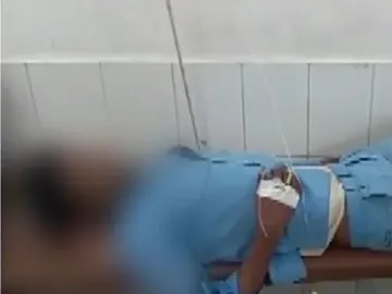 El hombre con la pierna supuestamente utilizada como almohada El hombre con la pierna supuestamente utilizada como almohada
