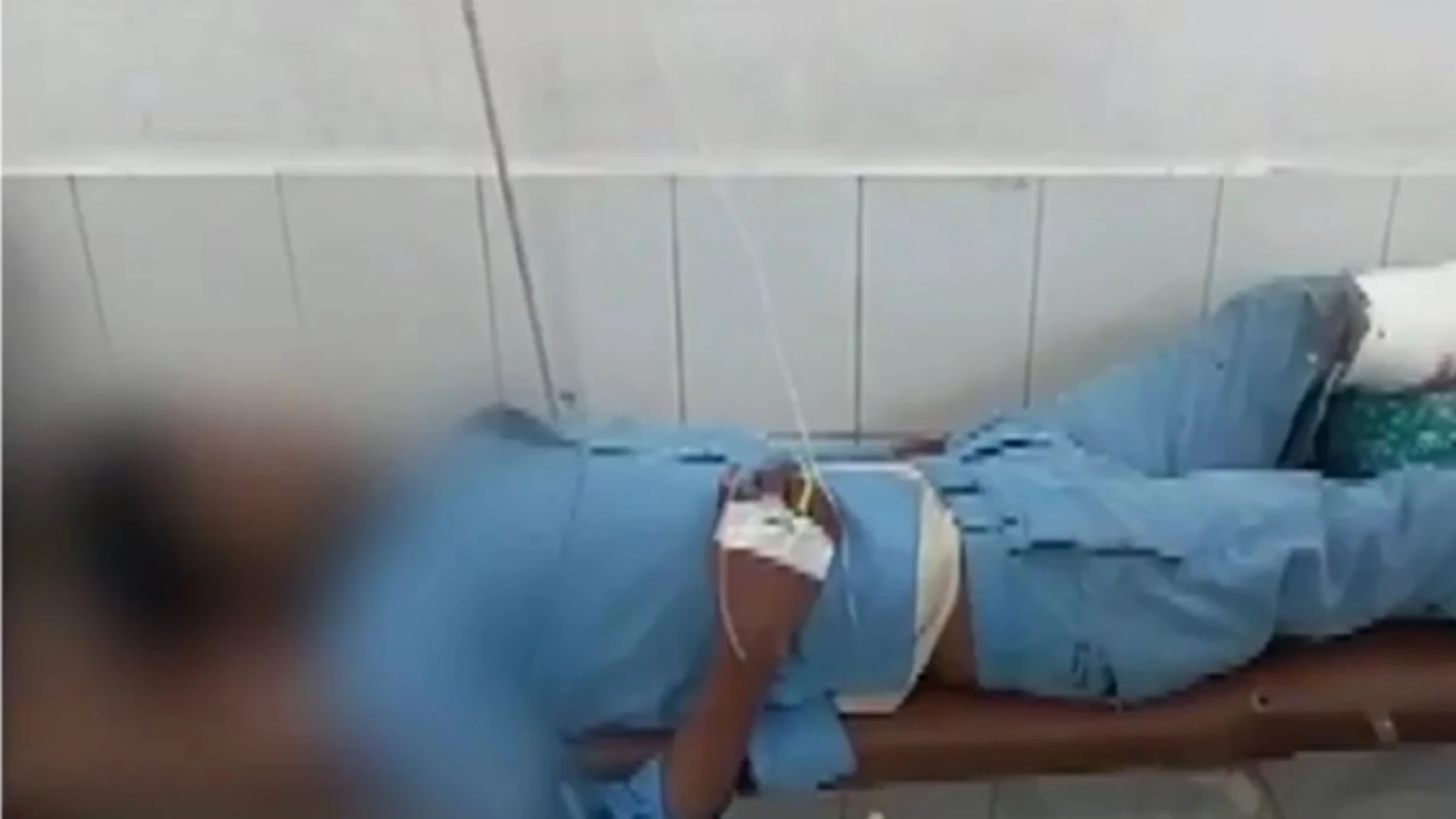El hombre con la pierna supuestamente utilizada como almohada El hombre con la pierna supuestamente utilizada como almohada