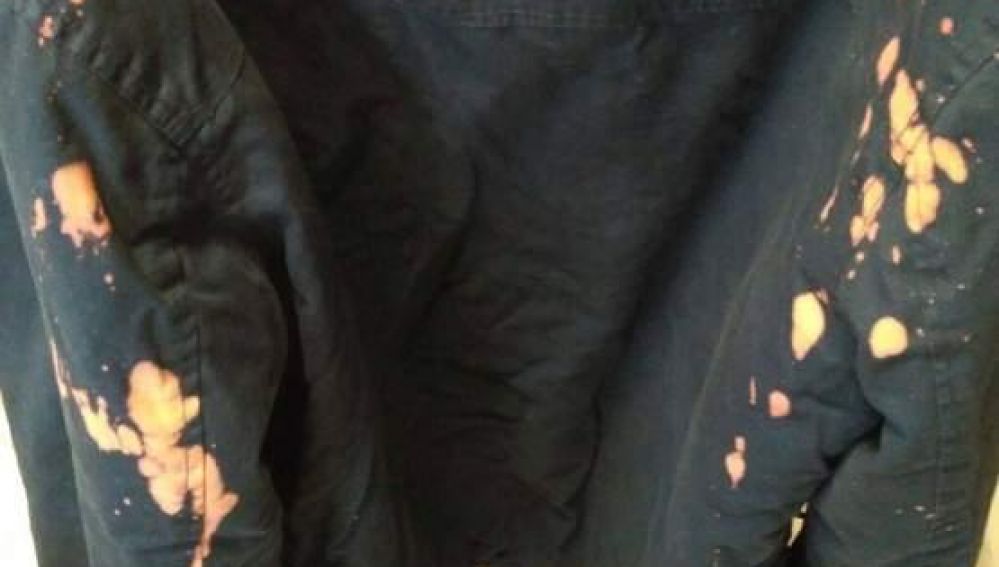 Resultado de la chaqueta del menor tras la agresión