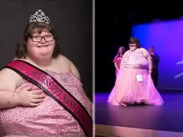 Una adolescente con una extraña patología y 172 kilos de peso gana un concurso de belleza en EEUU Una adolescente con una extraña patología y 172 kilos de peso gana un concurso de belleza en EEUU