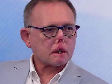 El doctor Jaco Nel El doctor Jaco Nel