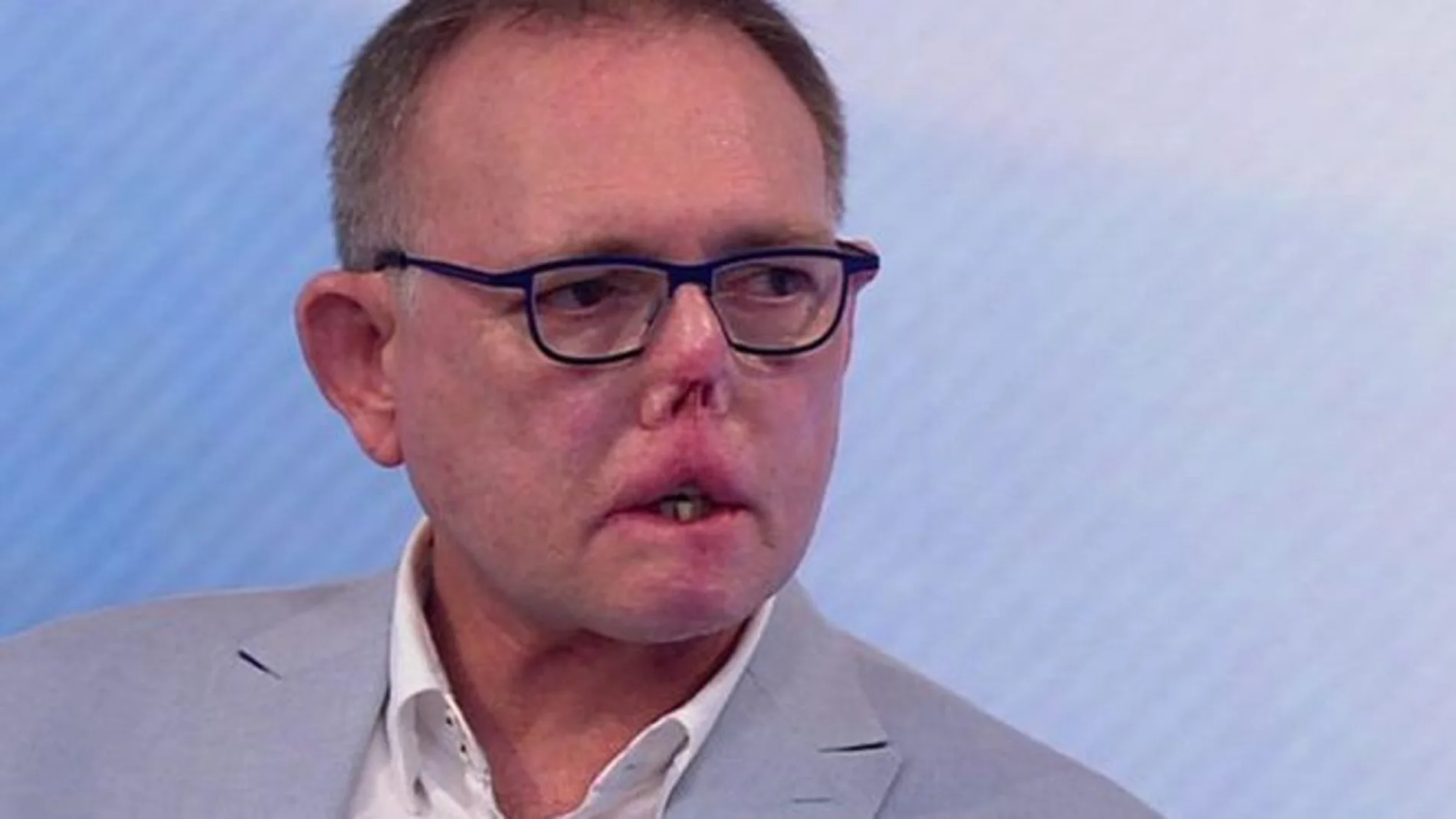 El doctor Jaco Nel El doctor Jaco Nel